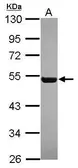 Anti-RGL4 antibody [N2C3] used in Western Blot (WB). GTX119584