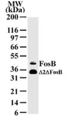 Anti-Fos B antibody [83B1138] used in Western Blot (WB). GTX11959