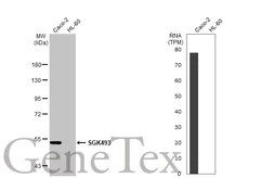 Anti-SGK493 antibody [N2C2], Internal used in Western Blot (WB). GTX119593