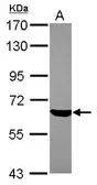 Anti-ZNF307 antibody [N1C1] used in Western Blot (WB). GTX119595