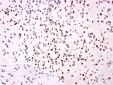 Anti-OTP antibody used in IHC (Paraffin sections) (IHC-P). GTX119601