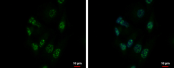 Anti-ZNF624 antibody used in Immunocytochemistry/ Immunofluorescence (ICC/IF). GTX119609