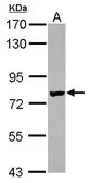 Anti-Netrin G1 ligand antibody [C1C3] used in Western Blot (WB). GTX119612