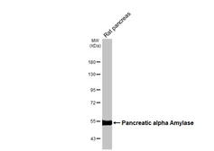 Anti-alpha Amylase antibody [N2C2], Internal used in Western Blot (WB). GTX119617