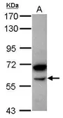 Anti-alpha amylase 2B (pancreatic) antibody [N2C2], Internal used in Western Blot (WB). GTX119617