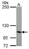 Anti-KA1 antibody [N2N3] used in Western Blot (WB). GTX119621