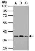 Anti-Pyruvate Dehydrogenase E1 beta subunit antibody used in Western Blot (WB). GTX119625