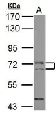 Anti-CALM antibody used in Western Blot (WB). GTX119631