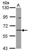 Anti-IL1RL2 antibody [C1C3] used in Western Blot (WB). GTX119632