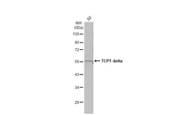 Anti-TCP1 delta antibody [N1C2] used in Western Blot (WB). GTX119638