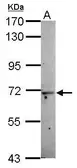 Anti-MOXD1 antibody [C1C3] used in Western Blot (WB). GTX119648