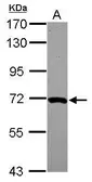 Anti-MOXD1 antibody [N2C2], Internal used in Western Blot (WB). GTX119649