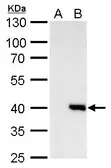 Anti-Macro H2A.2 antibody [N1C1] used in Western Blot (WB). GTX119657