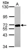 Anti-ZNF587 antibody [C1C3] used in Western Blot (WB). GTX119668