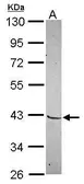 Anti-MKX antibody [N2C3] used in Western Blot (WB). GTX119679