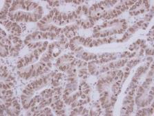 Anti-ASC1 antibody [N1C1] used in IHC (Paraffin sections) (IHC-P). GTX119681