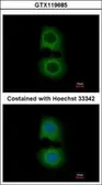 Anti-Tropomodulin 2 antibody [N3C3] used in Immunocytochemistry/ Immunofluorescence (ICC/IF). GTX119685