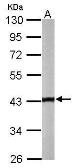 Anti-Tropomodulin 2 antibody [N3C3] used in Western Blot (WB). GTX119685