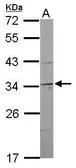 Anti-NRBF2 antibody [N2C3] used in Western Blot (WB). GTX119687