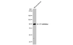 Anti-C1 inhibitor antibody [C1C3] used in Western Blot (WB). GTX119690