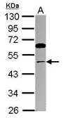 Anti-TRIP13 antibody [N1C2] used in Western Blot (WB). GTX119696
