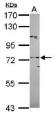 Anti-POT1 antibody [N1C1-2] used in Western Blot (WB). GTX119700