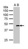 Anti-Pygopus 2 antibody used in Immunoprecipitation (IP). GTX119726