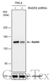 Anti-Rad50 antibody [N1N2], N-term used in Western Blot (WB). GTX119731