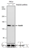 Anti-Rad50 antibody [C1C2], Internal used in Western Blot (WB). GTX119732