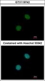 Anti-UBR7 antibody used in Immunocytochemistry/ Immunofluorescence (ICC/IF). GTX119742