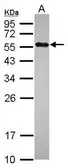 Anti-UBR7 antibody used in Western Blot (WB). GTX119742