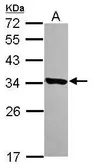 Anti-HDHD3 antibody [N1C3] used in Western Blot (WB). GTX119747