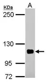 Anti-EPLIN antibody [N1N2], N-term used in Western Blot (WB). GTX119780