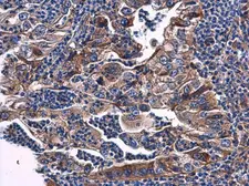 Anti-Phosphatase orphan 2 antibody [N1C3] used in IHC (Paraffin sections) (IHC-P). GTX119798