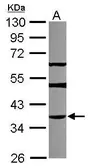 Anti-THAP11 antibody [N1C3] used in Western Blot (WB). GTX119804