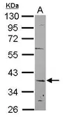 Anti-C12orf41 antibody [N1C2] used in Western Blot (WB). GTX119816