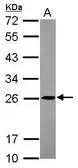 Anti-TMED5 antibody [N1C3] used in Western Blot (WB). GTX119825