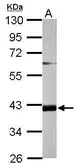 Anti-FAM46D antibody used in Western Blot (WB). GTX119865