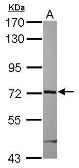 Anti-ARHGAP9 antibody used in Western Blot (WB). GTX119870