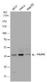 Anti-PABPC5 antibody [N1C2] used in Western Blot (WB). GTX119883