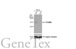 Anti-PGAM5 antibody used in Western Blot (WB). GTX119887