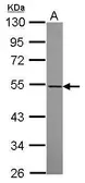 Anti-RASGEF1A antibody [N1C1] used in Western Blot (WB). GTX119891