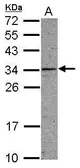 Anti-CCDC107 antibody used in Western Blot (WB). GTX119909