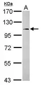 Anti-FCHO1 antibody [N1N2], N-term used in Western Blot (WB). GTX119927