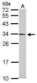 Anti-FAM78B antibody [N2C3] used in Western Blot (WB). GTX119928