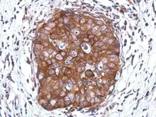 Anti-DCUN1D2 antibody [N2C3] used in IHC (Paraffin sections) (IHC-P). GTX119936