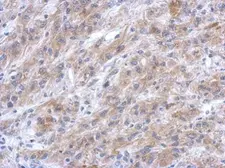 Anti-EFHC2 antibody [N1N3] used in IHC (Paraffin sections) (IHC-P). GTX119943