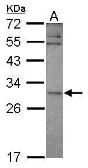 Anti-SNF8 antibody used in Western Blot (WB). GTX119948