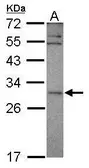 Anti-SNF8 antibody used in Western Blot (WB). GTX119948