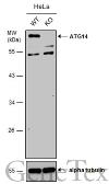 Anti-ATG14 antibody used in Western Blot (WB). GTX119950